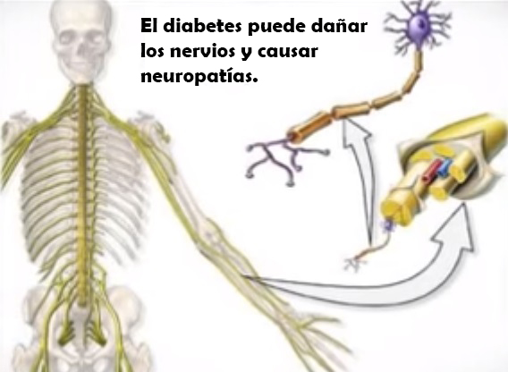 El cannabis y la diabetes