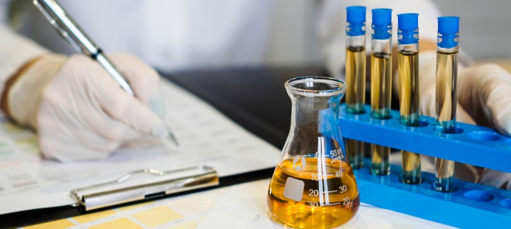 Análisis duración del THC en el organismo