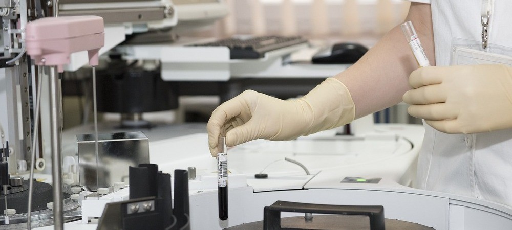 Fonctionnement d’un test salivaire