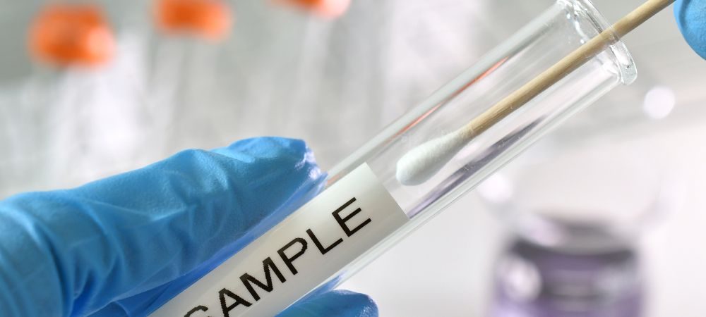 Legalità dei test antidroga sul lavoro