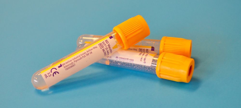 Procedure dei test antidroga