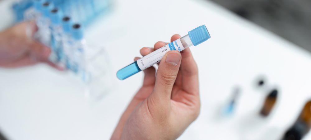 Cómo dar negativo en un test de saliva de drogas