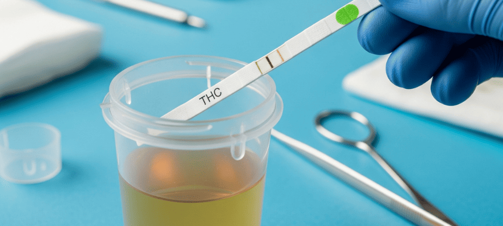 dar negativo test de drogas en orina